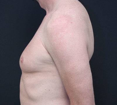 before profile-26060