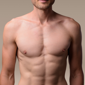 Gynecomastia sq