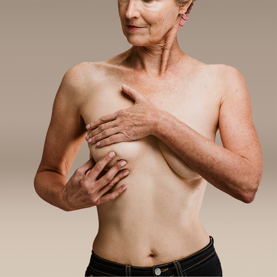 Lumpectomy-Reconstruction-Plastic-Surgery-Northwest-sq